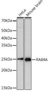 Anti-Rab4 Rabbit Monoclonal Antibody [clone: ARC2607]