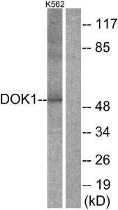 Western blot analysis of lysates from K562 cells, treated with Starvation 24 h using Anti-p62 Dok Antibody. The right hand lane represents a negative control, where the Antibody is blocked by the immunising peptide