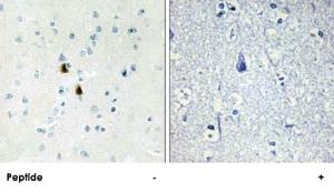 Anti-PKIA Rabbit Polyclonal Antibody