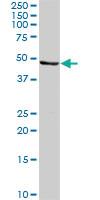 Anti-CALR3 Rabbit Polyclonal Antibody