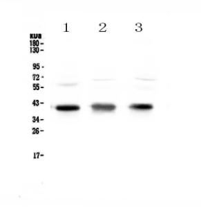 Anti-CCR4 Polyclonal Antibody