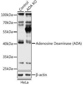 Western blot analysis of extracts from normal (control) and Adenosine Deaminase (Adenosine Deaminase (ADA)) knockout (KO) HeLa cells, using Anti-ADA Antibody (A92925) at 1:3,000 dilution. The secondary antibody was Goat Anti-Rabbit IgG H&L Antibody (HRP) at 1:10,000 dilution.