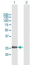 Anti-ADH6 Mouse Polyclonal Antibody