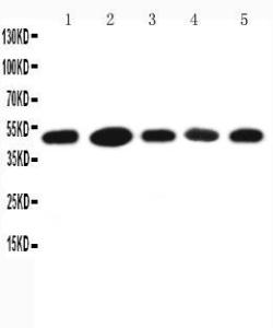 Anti-HSC70 Interacting Protein HIP Rabbit Polyclonal Antibody