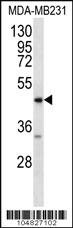 Anti-RAGE (AGER) Rabbit Polyclonal Antibody