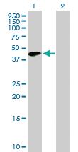 Anti-TMOD2 Mouse Polyclonal Antibody