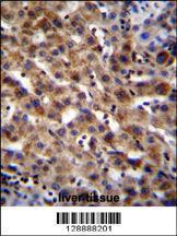 Anti-SPACA5B Rabbit Polyclonal Antibody (Biotin)