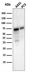 Western blot analysis of A431 and PC-3 cell lysates using Anti-CD73 Antibody [NT5E/2503]