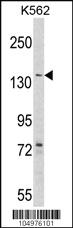 Anti-AGL Rabbit Polyclonal Antibody