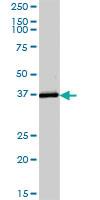 Anti-ADH6 Mouse Polyclonal Antibody