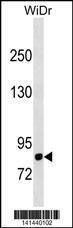 Anti-DPP4 Rabbit Polyclonal Antibody (HRP (Horseradish Peroxidase))