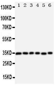 Anti-Aquaporin 4 Rabbit Polyclonal Antibody