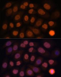 Immunofluorescence analysis of HeLa cells using Anti-KLF6 Antibody (A8504) at a dilution of 1:100. DAPI was used to stain the cell nuclei (blue)