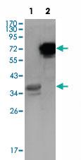 Anti-HPS1 Mouse Monoclonal Antibody [clone: 5G12G2]