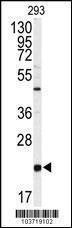 Anti-Prostatic Binding Protein Rabbit Polyclonal Antibody (AP (Alkaline Phosphatase))