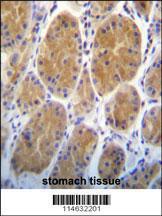 Anti-tRNA Synthetase, Alanyl Rabbit Polyclonal Antibody