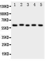 Anti-ASIC3 Rabbit Polyclonal Antibody