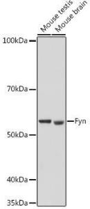 Western blot analysis of extracts of various cell lines, using Anti-Fyn Antibody (A309065) at 1:500 dilution