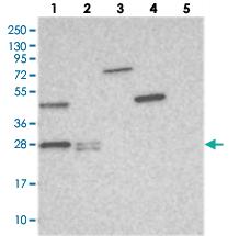 Anti-THYN1 Rabbit Polyclonal Antibody