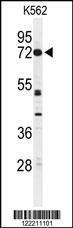 Anti-CNGA2 Rabbit Polyclonal Antibody (AP (Alkaline Phosphatase))