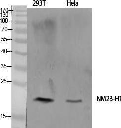 Western blot analysis of various cells using Anti-NM23-H1 Antibody