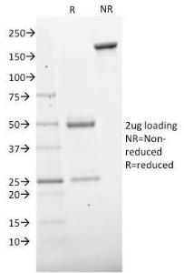 SDS-PAGE analysis of Anti-CD73 Antibody [NT5E/2503] under non-reduced and reduced conditions; showing intact IgG and intact heavy and light chains, respectively. SDS-PAGE analysis confirms the integrity and purity of the antibody