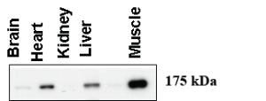 Anti-AGL Rabbit Polyclonal Antibody