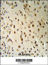 Anti-TARSL2 Rabbit Polyclonal Antibody (AP (Alkaline Phosphatase))