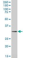 Anti-STOM Mouse Polyclonal Antibody