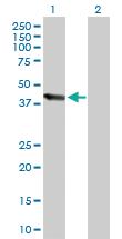 Anti-UBE3C Mouse Polyclonal Antibody