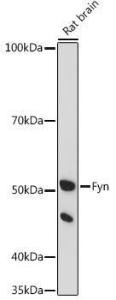 Western blot analysis of extracts of Rat brain, using Anti-Fyn Antibody (A309065) at 1:500 dilution