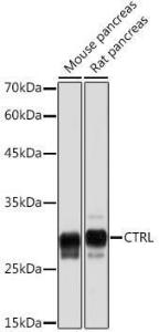 Western blot analysis of extracts of various cell lines, using Anti-CTRL Antibody [ARC2218] (A306145) at 1:5000 dilution