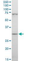 Anti-STOM Mouse Polyclonal Antibody