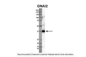 Anti-GNAI2 Rabbit Polyclonal Antibody