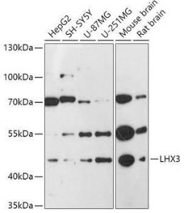 Western blot analysis of extracts of various cell lines, using Anti-LHX3/LIM Antibody (A92931) at 1:1000 dilution. The secondary Antibody was Goat Anti-Rabbit IgG H&L Antibody (HRP) at 1:10000 dilution. Lysates/proteins were present at 25 µg per lane