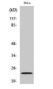 Western blot analysis of HeLa cells using Anti-NM23-H1 Antibody