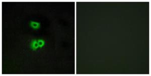 Immunofluorescence analysis of A549 cells using Anti-GPR101 Antibody. The right hand panel represents a negative control, where the Antibody was pre-incubated with the immunising peptide