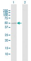 Anti-UBE3C Rabbit Polyclonal Antibody