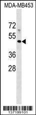 Anti-MR1 Rabbit Polyclonal Antibody (APC (Allophycocyanin))