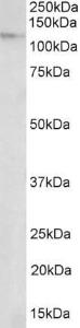 Anti-NUP107 Antibody (A84836) (2 µg/ml) staining of nuclear lysate of NIH3T3 (35 µg protein in RIPA buffer). Primary incubation was 1 hour. Detected by chemiluminescence