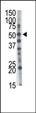 Anti-GCNT1 Rabbit Polyclonal Antibody