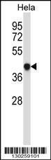 Anti-GRINA Rabbit Polyclonal Antibody (APC (Allophycocyanin))