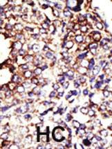 Anti-GCNT1 Rabbit Polyclonal Antibody