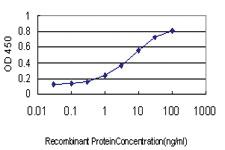 Anti-PTCH1 Mouse Monoclonal Antibody [clone: 8E1]