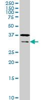 Anti-HEYL Mouse Monoclonal Antibody [clone: 4A11]