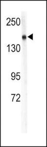 Anti-COL4A1 Rabbit Polyclonal Antibody (HRP (Horseradish Peroxidase))