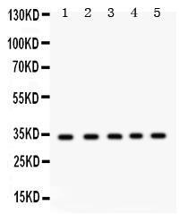 Anti-EBAG9 Rabbit Polyclonal Antibody