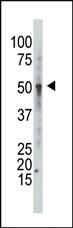 Anti-GCNT1 Rabbit Polyclonal Antibody