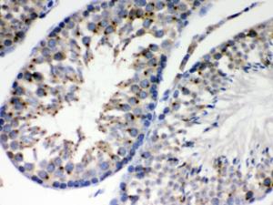 Anti-EBAG9 Rabbit Polyclonal Antibody