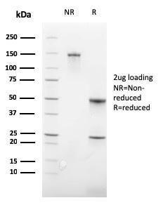 SDS-PAGE analysis of Anti-Glycophorin A Antibody [GYPA/3219R] under non-reduced and reduced conditions; showing intact IgG and intact heavy and light chains, respectively. SDS-PAGE analysis confirms the integrity and purity of the antibody.